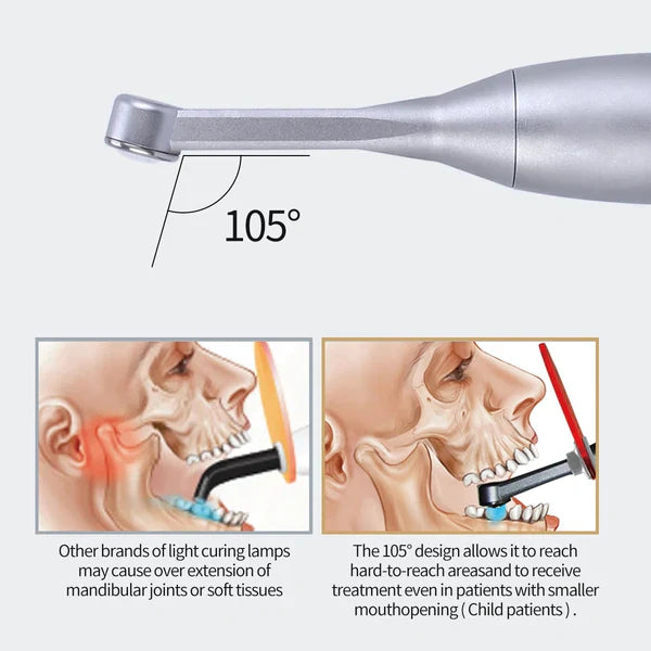 fotopolimerizador odontológico
fotopolimerizador
fotopolimerizador sem fio
ultrassom portatil odontologico