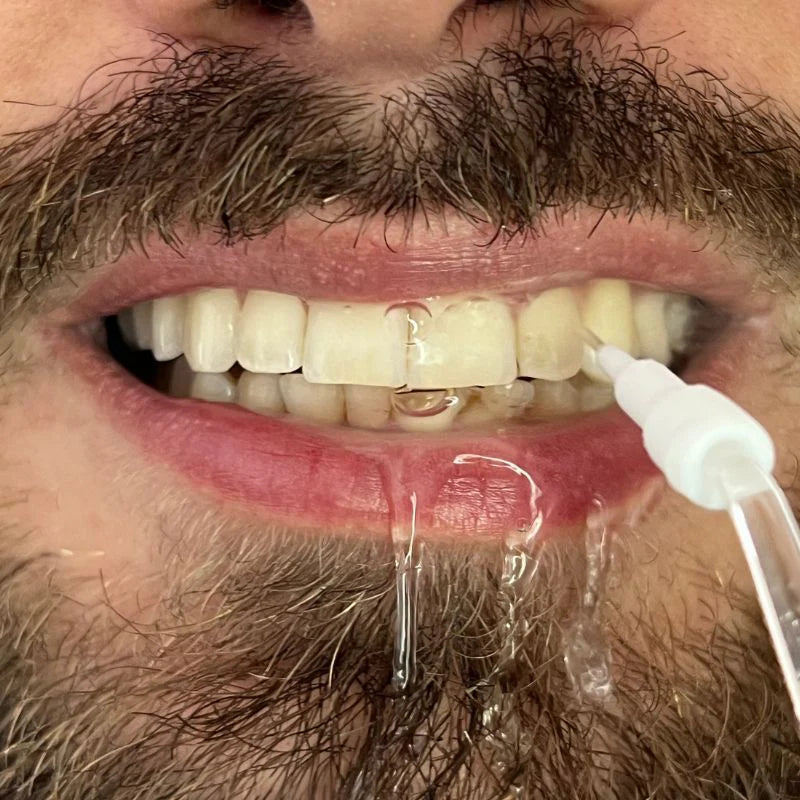 Irrigador Oral Limpeza Profunda Jato D àgua Supersônico